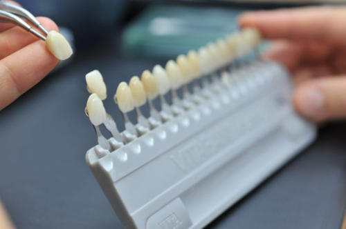 Biologischen Zahnmedizin